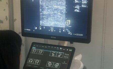 Alla Radiologia di Avezzano un nuovo ecografo per diagnosi di qualità